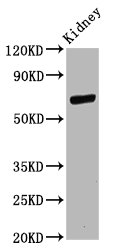 Western Blot | Positive WB detected in: Rat kidney tissue | All lanes: CD2AP antibody at 11μg/ml | Secondary | Goat polyclonal to rabbit IgG at 1/50000 dilution | Predicted band size: 72 kDa | Observed band size: 72 kDaRabbit anti-Human CD2AP Polyclonal Antibody