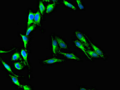 Immunofluorescent analysis of Hela cells using CD37 Antibody at dilution of 1:100 and Alexa Fluor 488-congugated AffiniPure Goat Anti-Rabbit IgG(H+L)Rabbit anti-Human CD37 Polyclonal Antibody