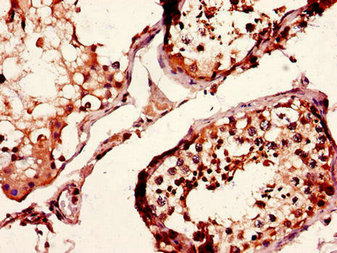 Immunohistochemistry of paraffin-embedded human testis tissue using CD37 Antibody at dilution of 1:100Rabbit anti-Human CD37 Polyclonal Antibody
