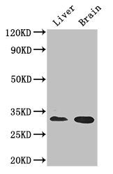 Western Blot | Positive WB detected in: Mouse liver tissue, Mouse brain tissue | All lanes: CD37 antibody at 2.7μg/ml | Secondary | Goat polyclonal to rabbit IgG at 1/50000 dilution | Predicted band size: 32, 24, 23 kDa | Observed band size: 32 kDaRabbit anti-Human CD37 Polyclonal Antibody