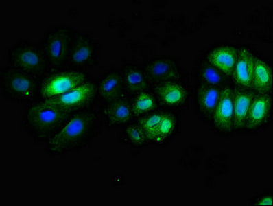 Immunofluorescent analysis of A549 cells using CD3E Antibody at dilution of 1:100 and Alexa Fluor 488-congugated AffiniPure Goat Anti-Rabbit IgG(H+L)Rabbit anti-Human CD3E Polyclonal Antibody