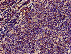 Immunohistochemistry of paraffin-embedded human lymph node tissue using the antibody at dilution of 1:100Rabbit anti-Human CD3E Polyclonal Antibody