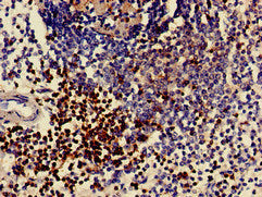 Immunohistochemistry of paraffin-embedded human spleen tissue using CD3E Antibody at dilution of 1:100Rabbit anti-Human CD3E Polyclonal Antibody