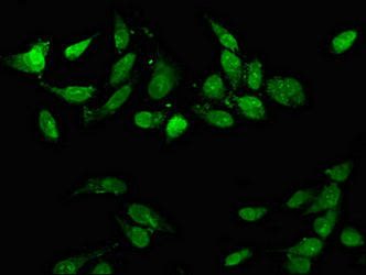 Immunofluorescence staining of Hela cells with CD3EAP Antibody at 1:66, counter-stained with DAPI. The cells were fixed in 4% formaldehyde, permeabilized using 0.2% Triton X-100 and blocked in 10% normal Goat Serum. The cells were then incubated with the antibody overnight at 4°C. The secondary antibody was Alexa Fluor 488-congugated AffiniPure Goat Anti-Rabbit IgG(H+L).Rabbit anti-Human CD3EAP Polyclonal Antibody