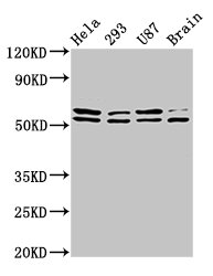 Western Blot | Positive WB detected in: Hela whole cell lysate, 293 whole cell lysate, U87 whole cell lysate, Rat brain tissue | All lanes: CD3EAP antibody at 3.9μg/ml | Secondary | Goat polyclonal to rabbit IgG at 1/50000 dilution | Predicted band size: 55, 56 kDa | Observed band size: 55, 56 kDaRabbit anti-Human CD3EAP Polyclonal Antibody
