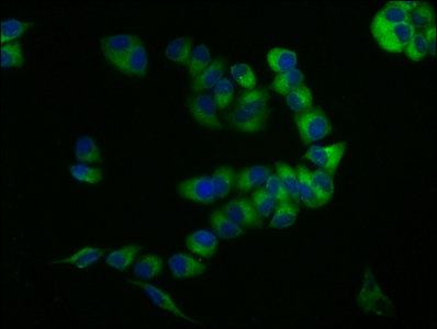 Immunofluorescence staining of PC-3 cells with CD59 Antibody at 1:133, counter-stained with DAPI. The cells were fixed in 4% formaldehyde, permeabilized using 0.2% Triton X-100 and blocked in 10% normal Goat Serum. The cells were then incubated with the antibody overnight at 4°C. The secondary antibody was Alexa Fluor 488-congugated AffiniPure Goat Anti-Rabbit IgG(H+L).Rabbit anti-Human CD59 Polyclonal Antibody