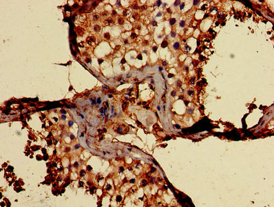 Immunohistochemistry of paraffin-embedded human testis tissue using CD59 Antibody at dilution of 1:100Rabbit anti-Human CD59 Polyclonal Antibody