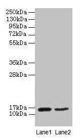 Western blot  | All lanes: CD59 antibody at 2µg/ml  | Lane 1: Mouse heart tissue  | Lane 2: NIH/3T3 whole cell lysate  | Secondary  | Goat polyclonal to rabbit IgG at 1/10000 dilution  | Predicted band size: 15 kDa  | Observed band size: 15 kDaRabbit anti-Human CD59 Polyclonal Antibody