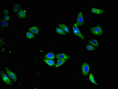 Immunofluorescent analysis of HepG2 cells using CD79A Antibody at dilution of 1:100 and Alexa Fluor 488-congugated AffiniPure Goat Anti-Rabbit IgG(H+L)Rabbit anti-Human CD79A Polyclonal Antibody