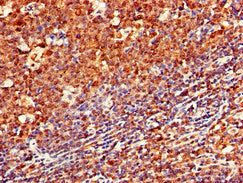 Immunohistochemistry of paraffin-embedded human tonsil tissue using the antibody at dilution of 1:100Rabbit anti-Human CD79A Polyclonal Antibody