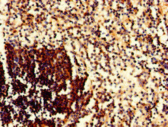 Immunohistochemistry of paraffin-embedded human spleen tissue using CD79A Antibody at dilution of 1:100Rabbit anti-Human CD79A Polyclonal Antibody