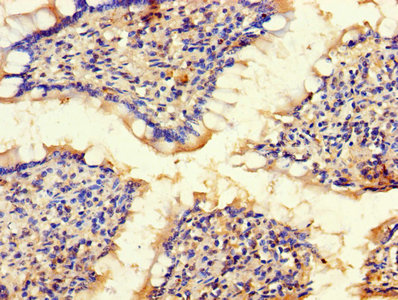 Immunohistochemistry of paraffin-embedded human small intestine tissue using BLOC1S1 Antibody at dilution of 1:100