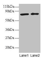 Western blot  | All lanes: BLOC1S1 antibody at 2µg/ml  | Lane 1: EC109 whole cell lysate  | Lane 2: 293T whole cell lysate  | Secondary  | Goat polyclonal to rabbit IgG at 1/15000 dilution  | Predicted band size: 18, 15 kDa  | Observed band size: 75 kDa