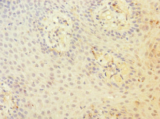 Immunohistochemistry of paraffin-embedded human tonsil tissue using CD97 Antibody at dilution of 1:100Rabbit anti-Human CD97 Polyclonal Antibody