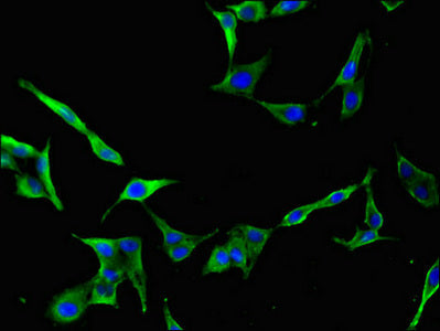 Immunofluorescent analysis of Hela cells using CDC25B Antibody at dilution of 1:100 and Alexa Fluor 488-congugated AffiniPure Goat Anti-Rabbit IgG(H+L)Rabbit anti-Human CDC25B Polyclonal Antibody