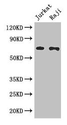 Western Blot  | Positive WB detected in: Jurkat whole cell lysate, Raji whole cell lysate  | All lanes: CDC25B antibody at 3µg/ml  | Secondary  | Goat polyclonal to rabbit IgG at 1/50000 dilution  | Predicted band size: 65, 64, 61, 68 kDa  | Observed band size: 65 kDaRabbit anti-Human CDC25B Polyclonal Antibody