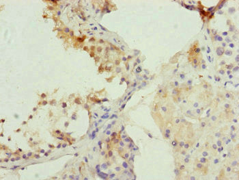 Immunohistochemistry of paraffin-embedded human testis tissue using CDC45 Antibody at dilution of 1:100Rabbit anti-Human CDC45 Polyclonal Antibody
