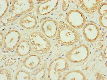 Immunohistochemistry of paraffin-embedded human kidney tissue using CDC45 Antibody at dilution of 1:100Rabbit anti-Human CDC45 Polyclonal Antibody