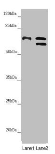 Western blot  | All lanes: CDC45 antibody at 1.05µg/ml  | Lane 1: K562 whole cell lysate  | Lane 2: 293T whole cell lysate  | Secondary  | Goat polyclonal to rabbit IgG at 1/10000 dilution  | Predicted band size: 66, 61, 69 kDa  | Observed band size: 66, 69 kDaRabbit anti-Human CDC45 Polyclonal Antibody