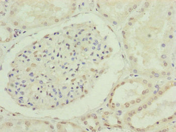 Immunohistochemistry of paraffin-embedded human kidney tissue using CDC45 Antibody at dilution of 1:100Rabbit anti-Human CDC45 Polyclonal Antibody