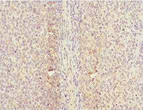 Immunohistochemistry of paraffin-embedded human tonsil tissue using CDC7 Antibody at dilution of 1:100Rabbit anti-Human CDC7 Polyclonal Antibody