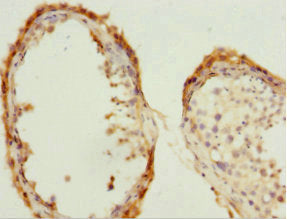 Immunohistochemistry of paraffin-embedded human testis tissue using CDC7 Antibody at dilution of 1:100Rabbit anti-Human CDC7 Polyclonal Antibody
