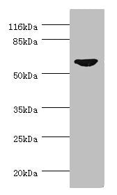 Western blot | All lanes: CDC7 antibody at 0.95μg/ml + SY-5Y whole cell lysate | Secondary | Goat polyclonal to rabbit IgG at 1/10000 dilution | Predicted band size: 64 kDa | Observed band size: 64 kDaRabbit anti-Human CDC7 Polyclonal Antibody