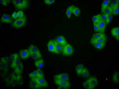 Immunofluorescence staining of HepG2 cells with CDH1 Antibody at 1:100, counter-stained with DAPI. The cells were fixed in 4% formaldehyde, permeabilized using 0.2% Triton X-100 and blocked in 10% normal Goat Serum. The cells were then incubated with the antibody overnight at 4°C. The secondary antibody was Alexa Fluor 488-congugated AffiniPure Goat Anti-Rabbit IgG(H+L).Rabbit anti-Human CDH1 Polyclonal Antibody