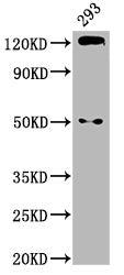Western Blot  | Positive WB detected in: 293 whole cell lysate  | All lanes: CDH1 antibody at 2.9µg/ml  | Secondary  | Goat polyclonal to rabbit IgG at 1/50000 dilution  | Predicted band size: 98, 91 kDa  | Observed band size: 125 kDaRabbit anti-Human CDH1 Polyclonal Antibody