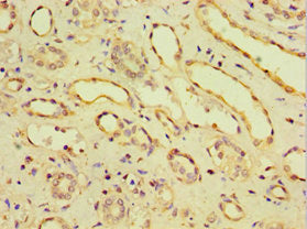 Immunohistochemistry of paraffin-embedded human kidney tissue using CDH11 Antibody at dilution of 1:100Rabbit anti-Human CDH11 Polyclonal Antibody