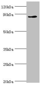 Western blot | All lanes: CDH11 antibody at 6μg/ml + Jurkat whole cell lysate | Secondary | Goat polyclonal to rabbit IgG at 1/10000 dilution | Predicted band size: 88, 77 kDa | Observed band size: 88 kDaRabbit anti-Human CDH11 Polyclonal Antibody