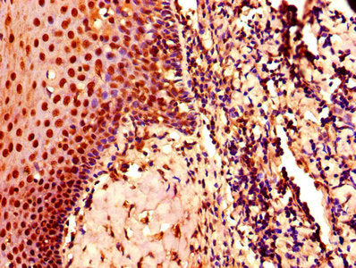 IHC image of CDK2 Antibody diluted at 1:800 and staining in paraffin-embedded human tonsil tissue performed on a Leica BondTM system. After dewaxing and hydration, antigen retrieval was mediated by high pressure in a citrate buffer (pH 6.0). Section was blocked with 10% normal goat serum 30min at RT. Then primary antibody (1% BSA) was incubated at 4°C overnight. The primary is detected by a biotinylated secondary antibody and visualized using an HRP conjugated SP system.Rabbit anti-Human CDK2 Polyclonal Antibody
