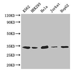 Western Blot  | Positive WB detected in: K562 whole cell lysate, HEK293 whole cell lysate, Hela whole cell lysate, Jurkat whole cell lysate, HepG2 whole cell lysate  | All lanes: CDK2 antibody at 2.6µg/ml  | Secondary  | Goat polyclonal to rabbit IgG at 1/50000 dilution  | Predicted band size: 34, 31 kDa  | Observed band size: 34 kDaRabbit anti-Human CDK2 Polyclonal Antibody