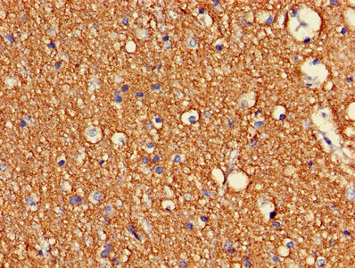 Immunohistochemistry of paraffin-embedded human brain tissue using CDK5 Antibody at dilution of 1:100Rabbit anti-Human CDK5 Polyclonal Antibody
