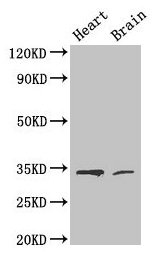 Western Blot  | Positive WB detected in: Mouse heart tissue, Mouse brain tissue  | All lanes: CDK5 antibody at 4µg/ml  | Secondary  | Goat polyclonal to rabbit IgG at 1/50000 dilution  | Predicted band size: 34, 30 kDa  | Observed band size: 34 kDaRabbit anti-Human CDK5 Polyclonal Antibody