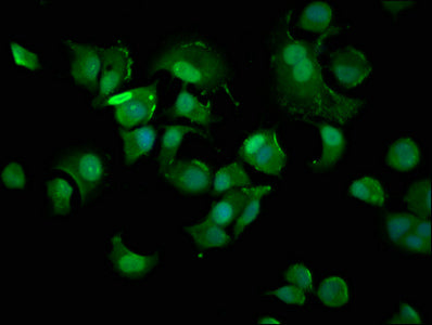 Immunofluorescence staining of MCF-7 cells with CDKN1A Antibody at 1:400, counter-stained with DAPI. The cells were fixed in 4% formaldehyde, permeabilized using 0.2% Triton X-100 and blocked in 10% normal Goat Serum. The cells were then incubated with the antibody overnight at 4°C. The secondary antibody was Alexa Fluor 488-congugated AffiniPure Goat Anti-Rabbit IgG(H+L).Rabbit anti-Human CDKN1A Polyclonal Antibody