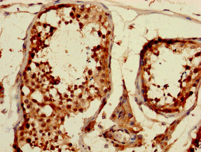 IHC image of the antibody diluted at 1:1200 and staining in paraffin-embedded human testis tissue performed on a Leica BondTM system. After dewaxing and hydration, antigen retrieval was mediated by high pressure in a citrate buffer (pH 6.0). Section was blocked with 10% normal goat serum 30min at RT. Then primary antibody (1% BSA) was incubated at 4°C overnight. The primary is detected by a biotinylated secondary antibody and visualized using an HRP conjugated SP system.Rabbit anti-Human CDKN1A Polyclonal Antibody