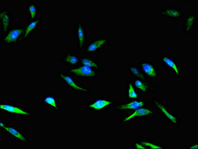 Immunofluorescent analysis of Hela cells using CDKN2B Antibody at dilution of 1:100 and Alexa Fluor 488-congugated AffiniPure Goat Anti-Rabbit IgG(H+L)Rabbit anti-Human CDKN2B Polyclonal Antibody