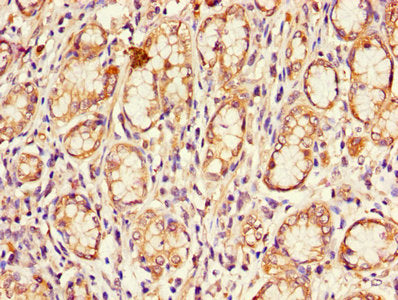 Immunohistochemistry of paraffin-embedded human stomach tissue using the antibody at dilution of 1:100Rabbit anti-Human CDKN2B Polyclonal Antibody