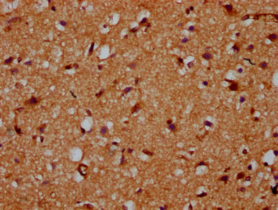 IHC image of CDS2 Antibody diluted at 1:200 and staining in paraffin-embedded human brain tissue performed on a Leica BondTM system. After dewaxing and hydration, antigen retrieval was mediated by high pressure in a citrate buffer (pH 6.0). Section was blocked with 10% normal goat serum 30min at RT. Then primary antibody (1% BSA) was incubated at 4°C overnight. The primary is detected by a biotinylated secondary antibody and visualized using an HRP conjugated SP system.Rabbit anti-Human CDS2 Polyclonal Antibody