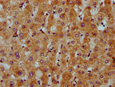 IHC image of CDS2 Antibody diluted at 1:200 and staining in paraffin-embedded human liver tissue performed on a Leica BondTM system. After dewaxing and hydration, antigen retrieval was mediated by high pressure in a citrate buffer (pH 6.0). Section was blocked with 10% normal goat serum 30min at RT. Then primary antibody (1% BSA) was incubated at 4°C overnight. The primary is detected by a biotinylated secondary antibody and visualized using an HRP conjugated SP system.Rabbit anti-Human CDS2 Polyclonal Antibody