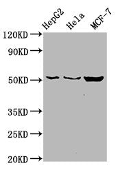 Western Blot  | Positive WB detected in: HepG2 whole cell lysate, Hela whole cell lysate, MCF-7 whole cell lysate  | All lanes: CDS2 antibody at 6µg/ml  | Secondary  | Goat polyclonal to rabbit IgG at 1/50000 dilution  | Predicted band size: 52, 30 kDa  | Observed band size: 52 kDaRabbit anti-Human CDS2 Polyclonal Antibody
