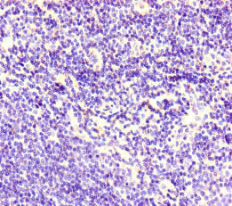 Immunohistochemistry of paraffin-embedded human lymph node tissue using the antibody at dilution of 1:100Rabbit anti-Human CDSN Polyclonal Antibody