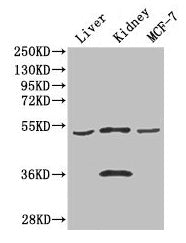 Western Blot  | Positive WB detected in: Mouse liver tissue, Mouse kidney tissue, MCF-7 whole cell lysate  | All lanes: CDSN antibody at 3μg/ml  | Secondary  | Goat polyclonal to rabbit IgG at 1/50000 dilution  | Predicted band size: 52 kDa  | Observed band size: 52, 36 kDaRabbit anti-Human CDSN Polyclonal Antibody