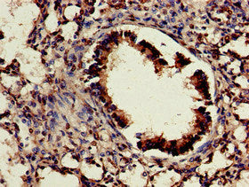 Immunohistochemistry of paraffin-embedded human lung tissue using CDX4 Antibody at dilution of 1:100Rabbit anti-Human CDX4 Polyclonal Antibody