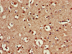Immunohistochemistry of paraffin-embedded human brain tissue using CDX4 Antibody at dilution of 1:100Rabbit anti-Human CDX4 Polyclonal Antibody
