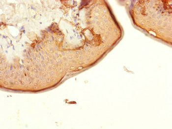 Immunohistochemistry of paraffin-embedded human skin tissue using CENPK Antibody at dilution of 1:100Rabbit anti-Human CENPK Polyclonal Antibody