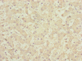 Immunohistochemistry of paraffin-embedded human liver tissue using CENPK Antibody at dilution of 1:100Rabbit anti-Human CENPK Polyclonal Antibody