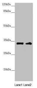 Western blot | All lanes: CENPK antibody at 3.98μg/ml | Lane 1: PC-3 whole cell lysate | Lane 2: 293T whole cell lysate | Secondary | Goat polyclonal to rabbit IgG at 1/10000 dilution | Predicted band size: 32 kDa | Observed band size: 32 kDaRabbit anti-Human CENPK Polyclonal Antibody