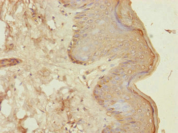 Immunohistochemistry of paraffin-embedded human skin tissue using CENPK Antibody at dilution of 1:100Rabbit anti-Human CENPK Polyclonal Antibody